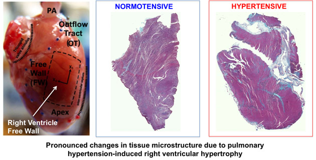 Ventricular Myocardium Model