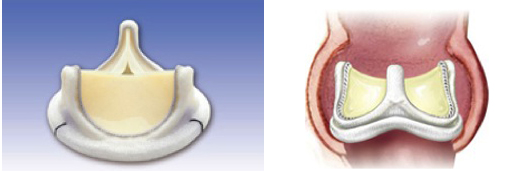 Bioprosthetic heart valves